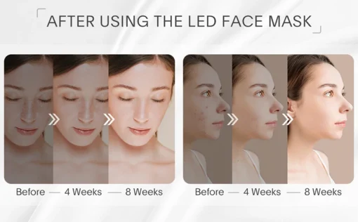 Masque facial LED sans fil – Image 5