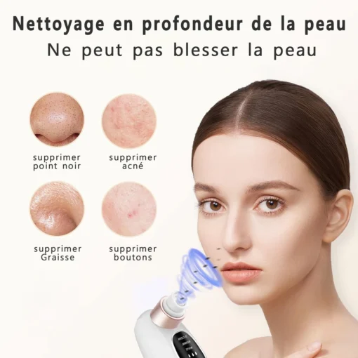 Aspirateur de points noirs, soin visage – Image 2