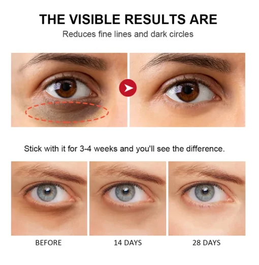 Crème pour les yeux au rétinol – Image 8