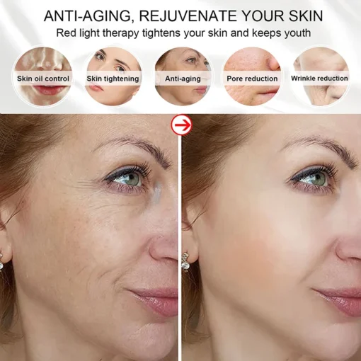 Masque facial LED sans fil – Image 2