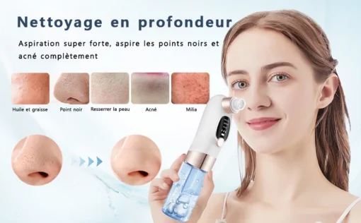 Aspirateur de points noirs, soin visage – Image 7