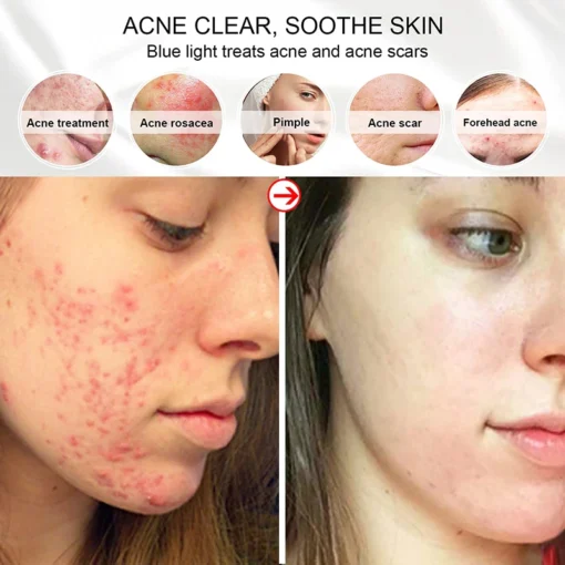 Masque facial LED sans fil – Image 3