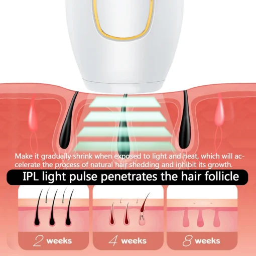 Épilateur Laser IPL corps Bikini – Image 4
