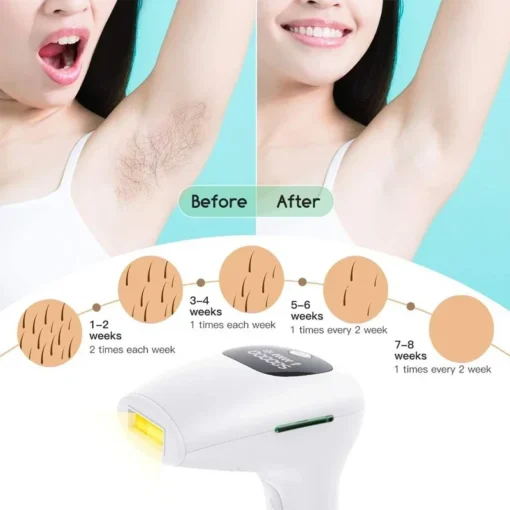 Épilateur laser IPL – Image 5